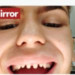 A un modelo para ahorrar dinero le renuevan los dientes en Türkiye: se convierte en tiburón