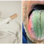 Fumatore con lingua pelosa e verde per una medicina generica: ecco quale