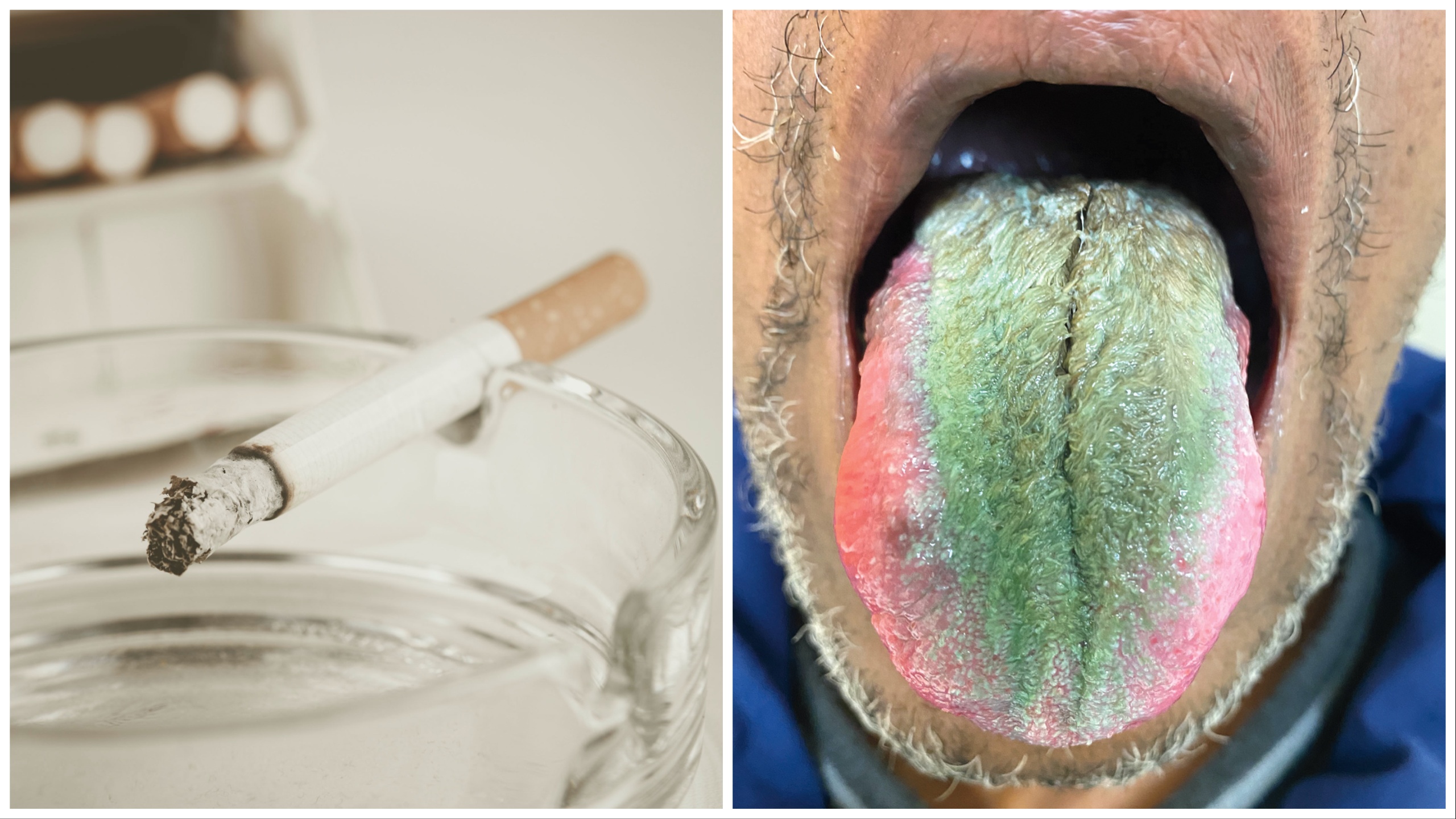 Raucher mit behaarter grüner Zunge für ein Generikum: Das ist es