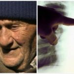 Doveva morire dopo 9 mesi, sopravvive 45 anni: la storia dell’isola che “inganna” il cancro