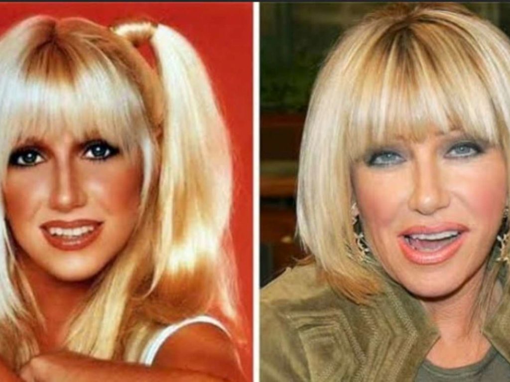 Suzanne Somers