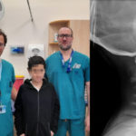 Bimbo decapitato in incidente stradale: i chirurghi fanno il miracolo