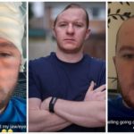 Braden Stromberg senza cranio dopo aggressione