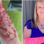 Donna attaccata da serpente piovuto dal cielo e poi da un falco: braccio maciullato