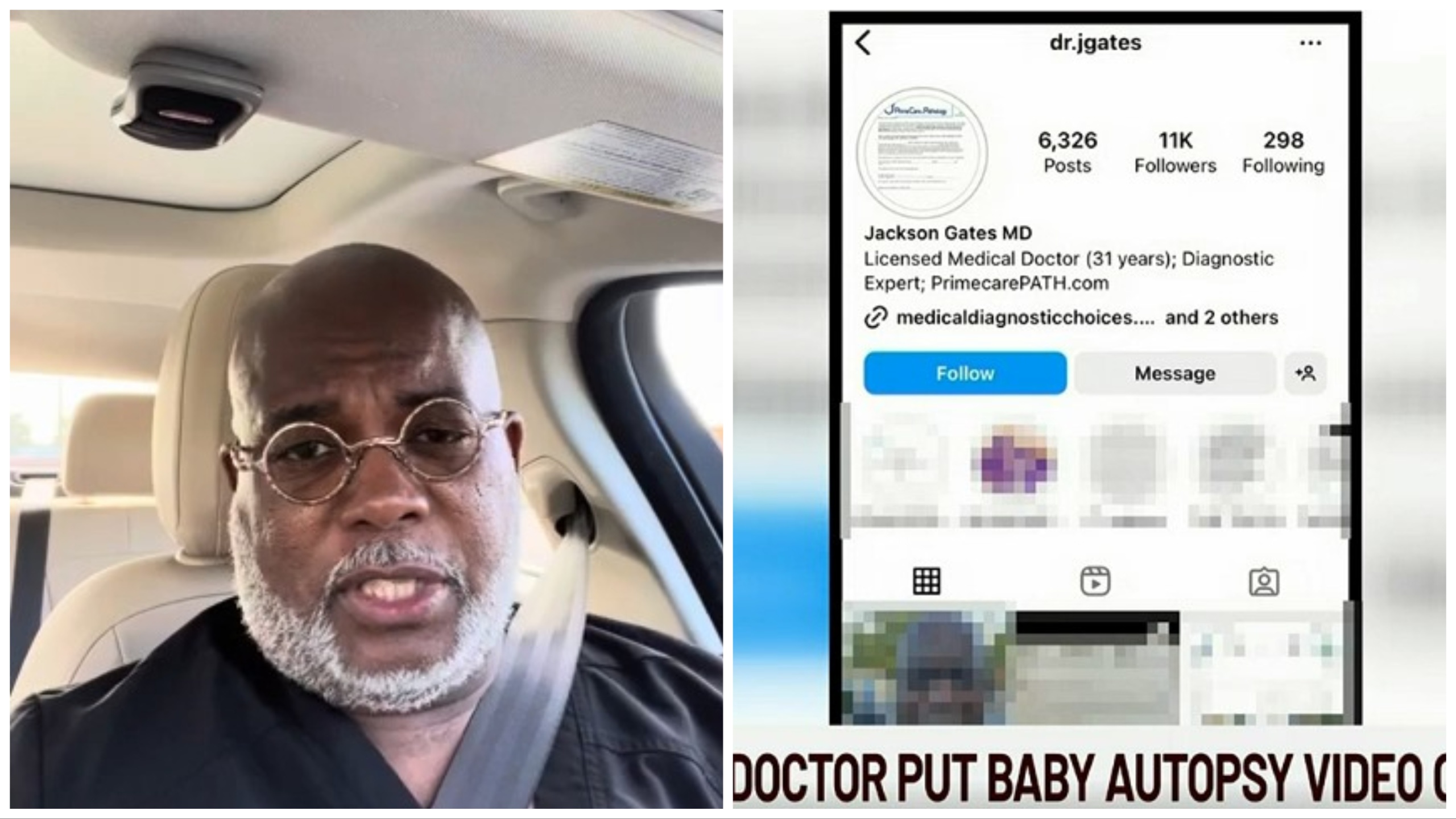 Bebé decapitado durante el parto, el médico publica la autopsia en línea: informó