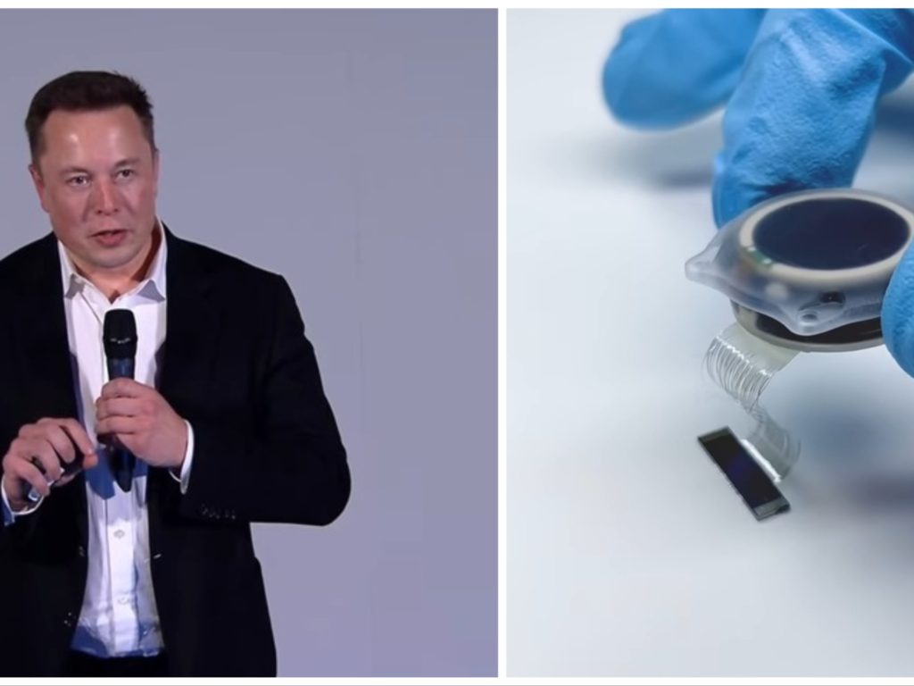 Musk busca conejillos de indias humanos para probar el chip cerebral: 1.500 animales murieron en las pruebas