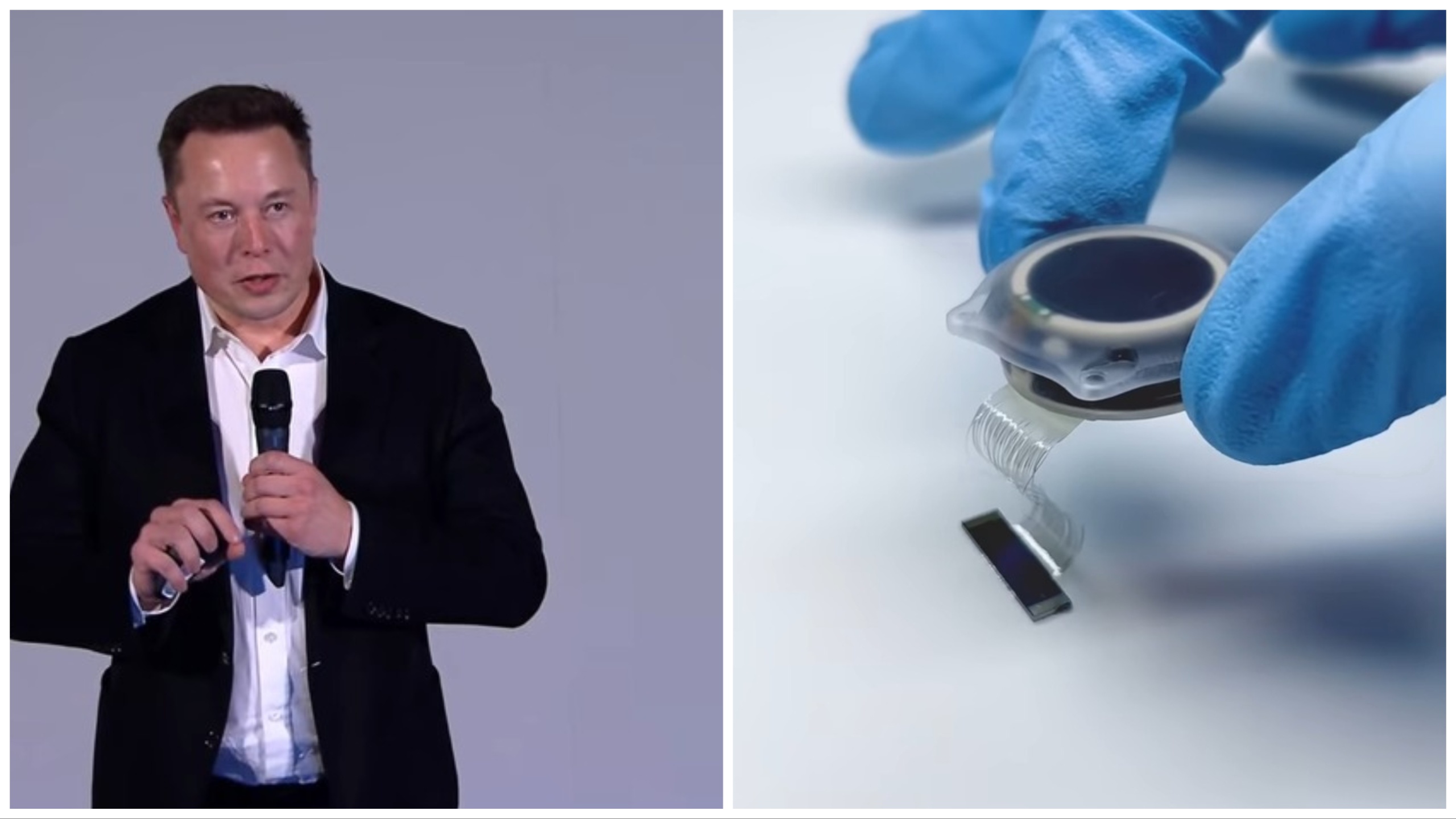 Musk busca conejillos de indias humanos para probar el chip cerebral: 1.500 animales murieron en las pruebas