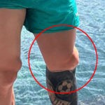 Il mostruoso ginocchio di Messi preoccupa i fan: ma c'è la spiegazione