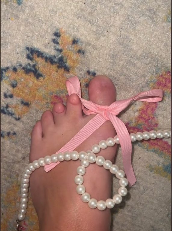 Nacida sin uñas de los pies, descubre en las redes sociales que no está sola: "He renacido"