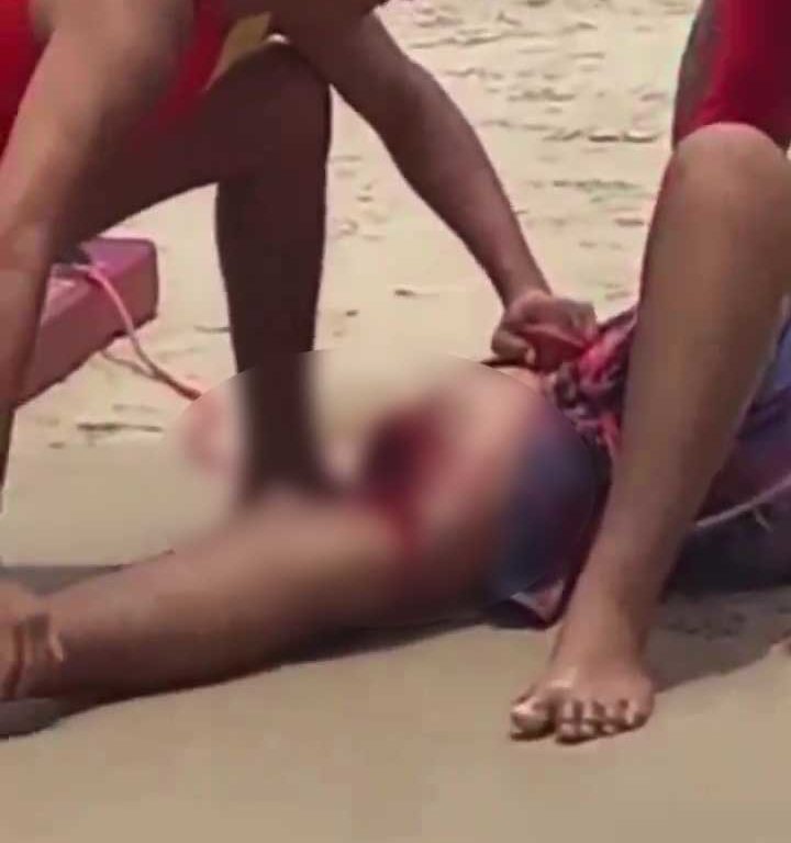 Madre si fa sbranare da squalo per salvare figlia di 5 anni: terrore in spiaggia