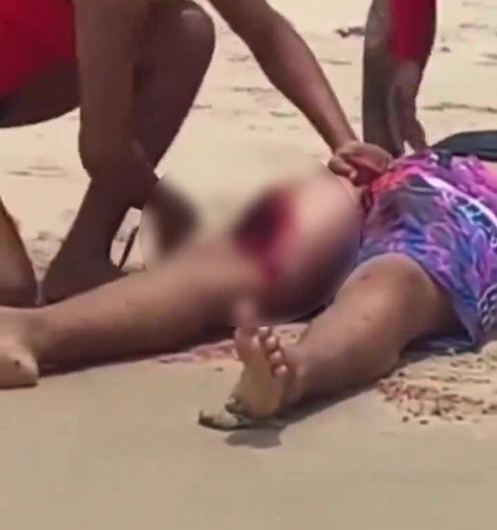 Madre es mutilada por un tiburón para salvar a su hija de 5 años: terror en la playa