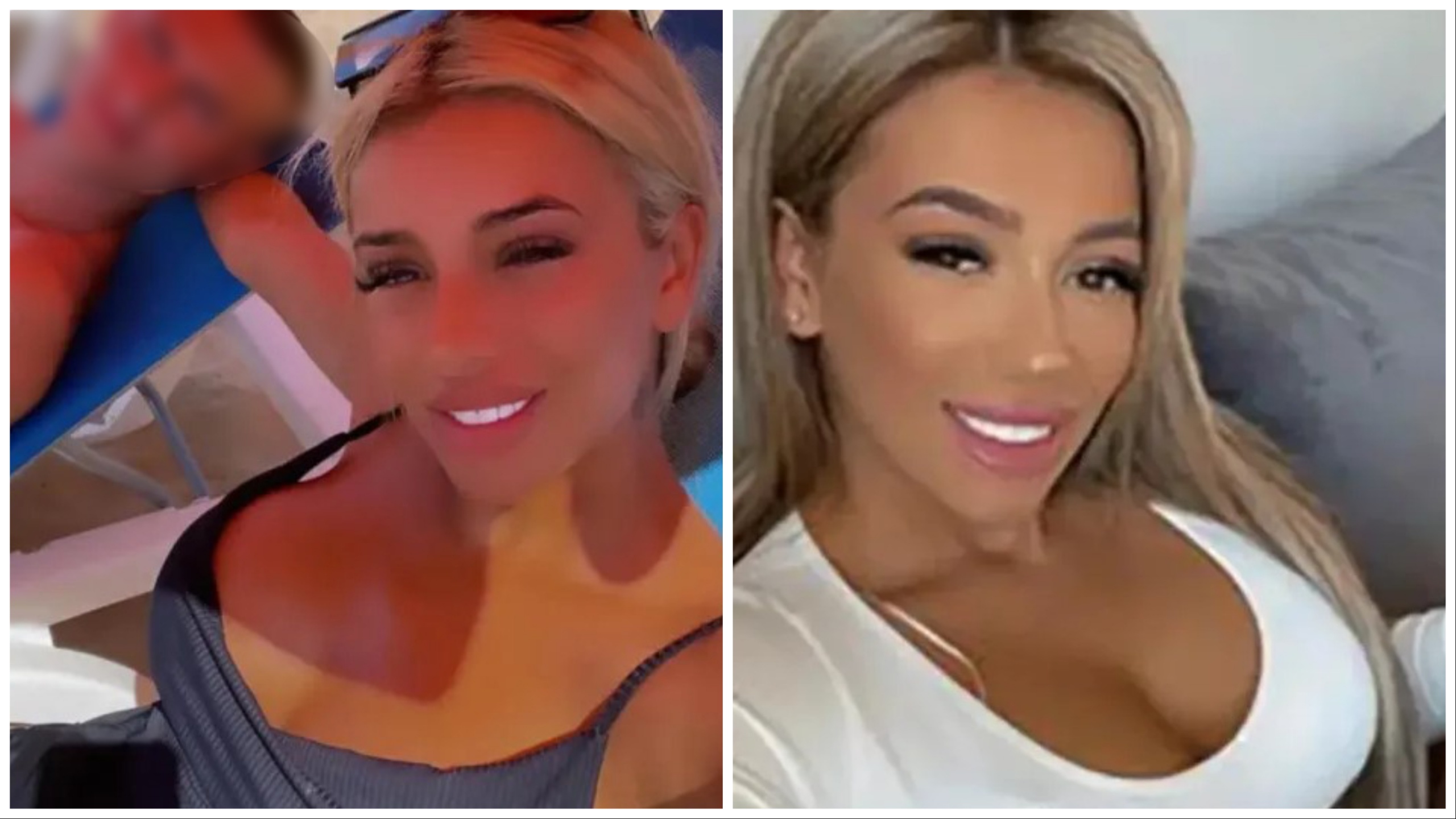 Vuela a Türkiye para hacerse los glúteos: joven de 26 años muere de un infarto