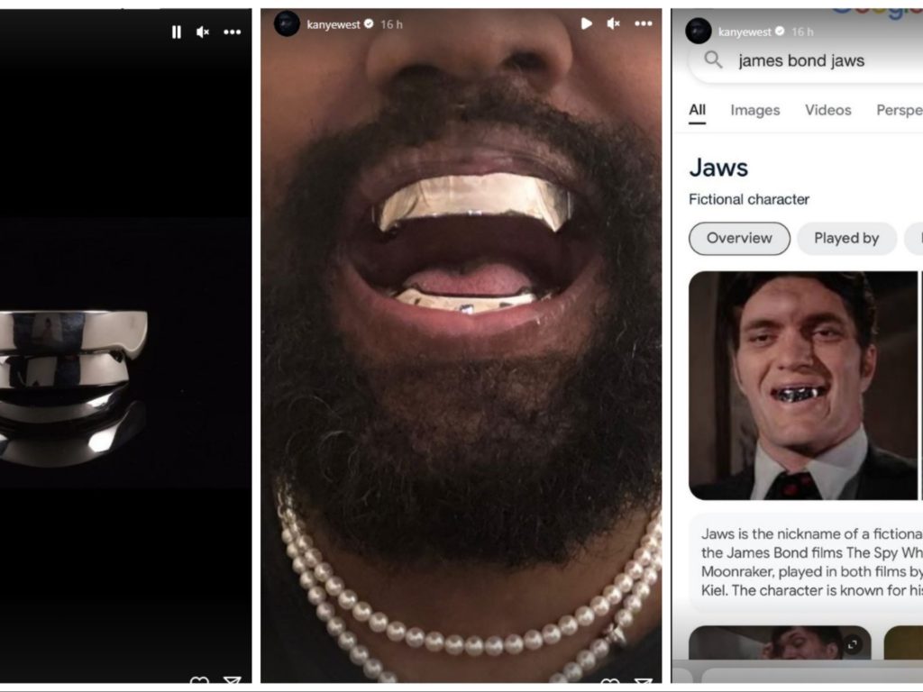 La última locura de Kanye West, utiliza dentaduras postizas por valor de 850 mil euros