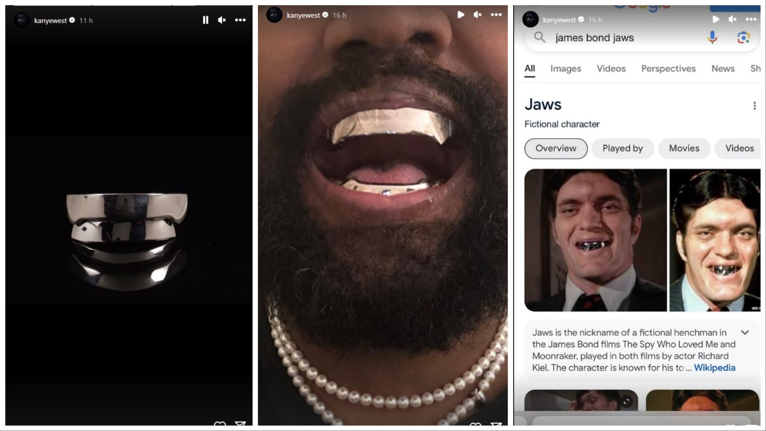 La última locura de Kanye West, utiliza dentaduras postizas por valor de 850 mil euros