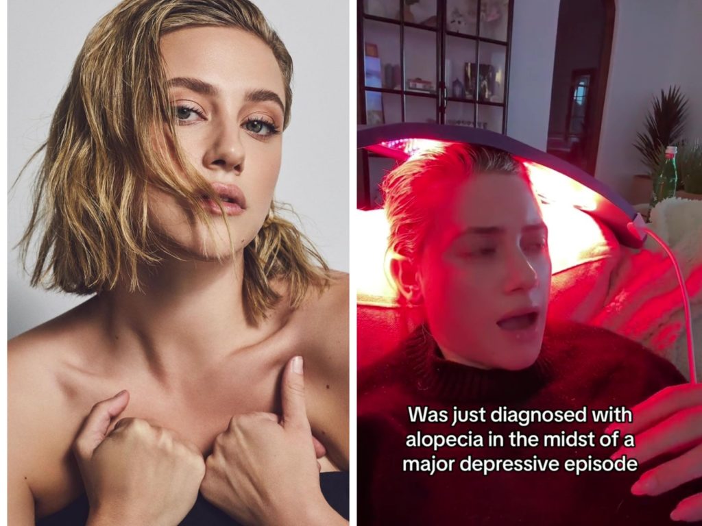 Lili Reinhart: Sie bekommt aufgrund einer Depression eine Glatze