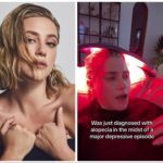Lili Reinhart: sta diventando calva per la depressione
