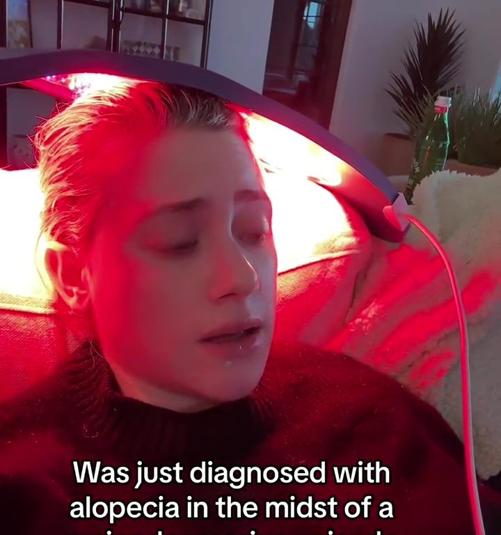 Lili Reinhart: Se está quedando calva debido a la depresión