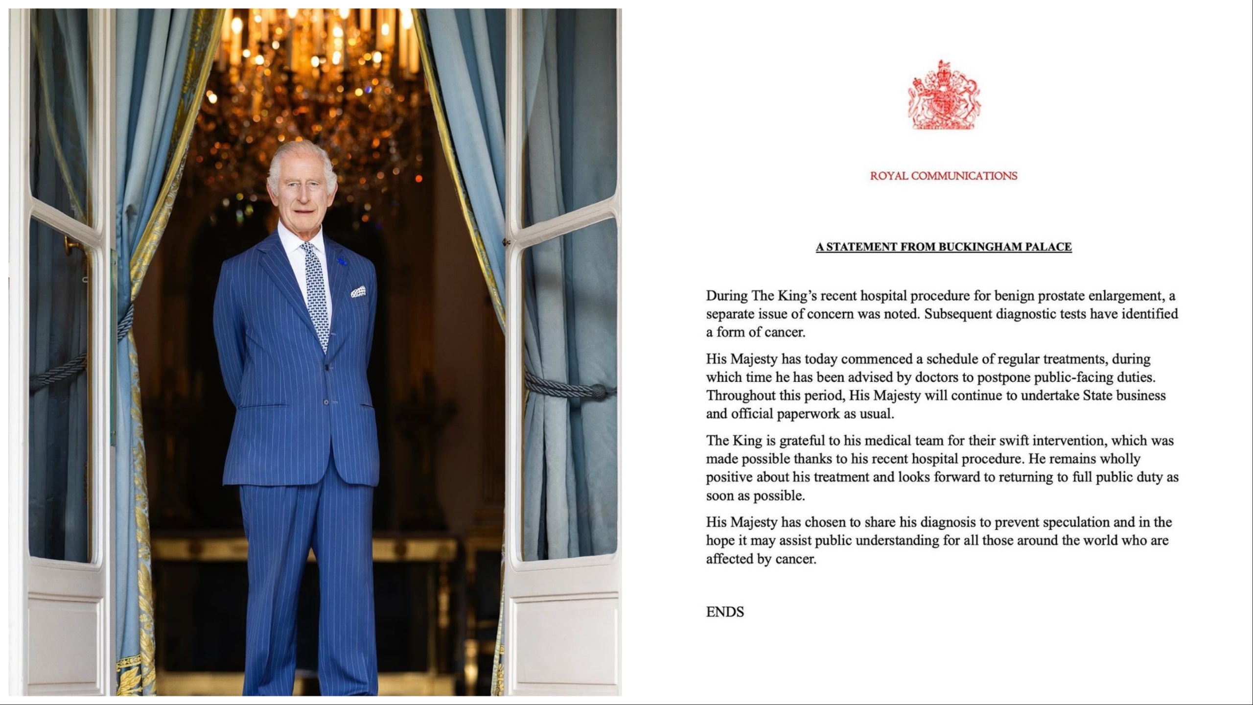 Re Carlo, esperti americani ipotizzano tumore alla vescica