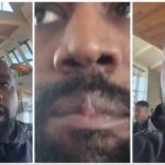 Escrescenze misteriose sul labbro di Kanye West: colpa dei nuovi denti?