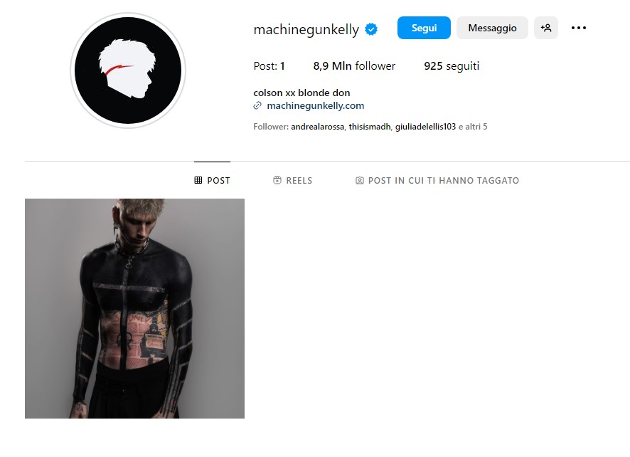 Schockierendes Tattoo von Machine Gun Kelly: Will er schwarz werden?