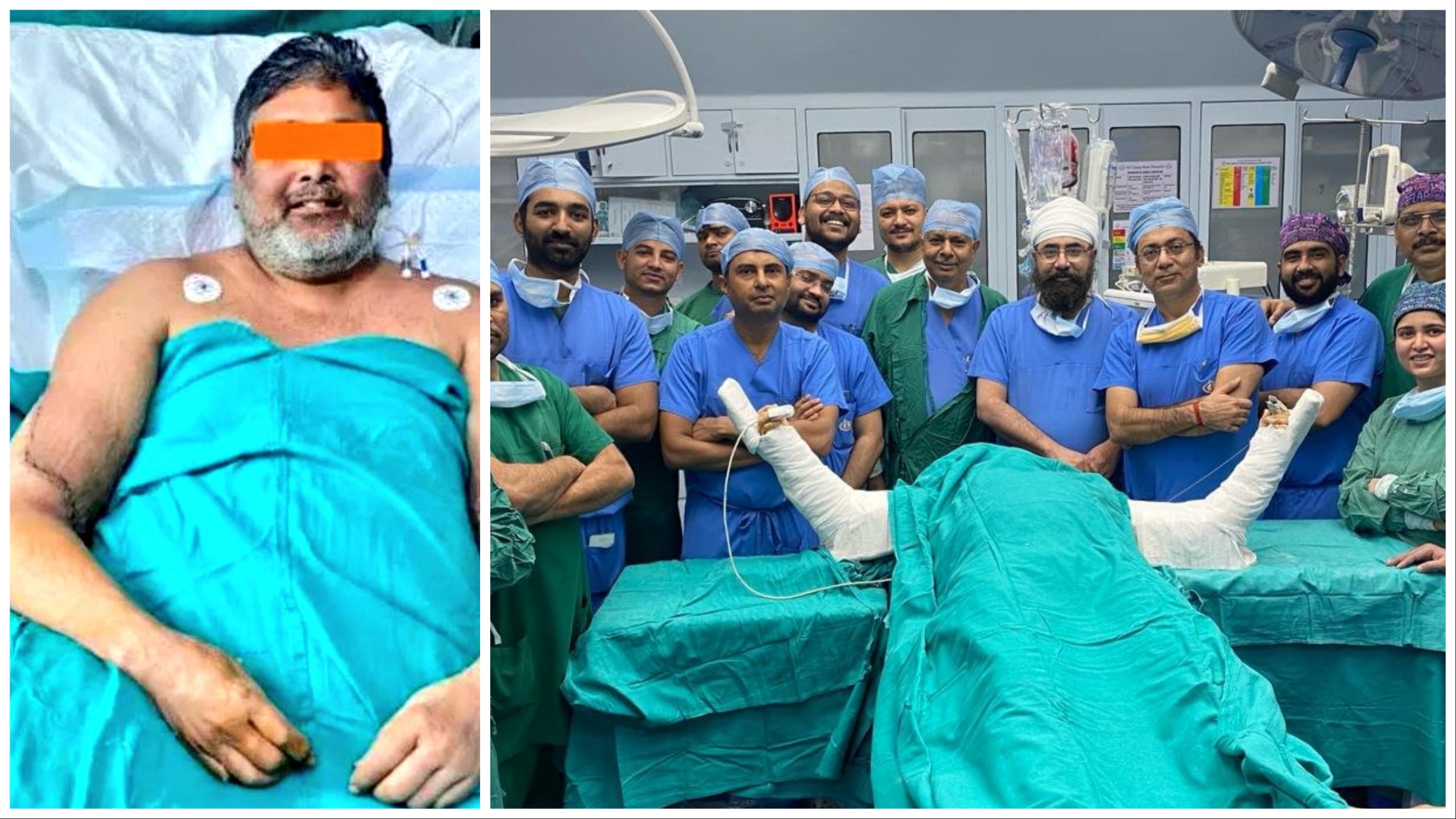 Imbianchino senza arti dopo incidente, ospedale gli riattacca le braccia di una donna