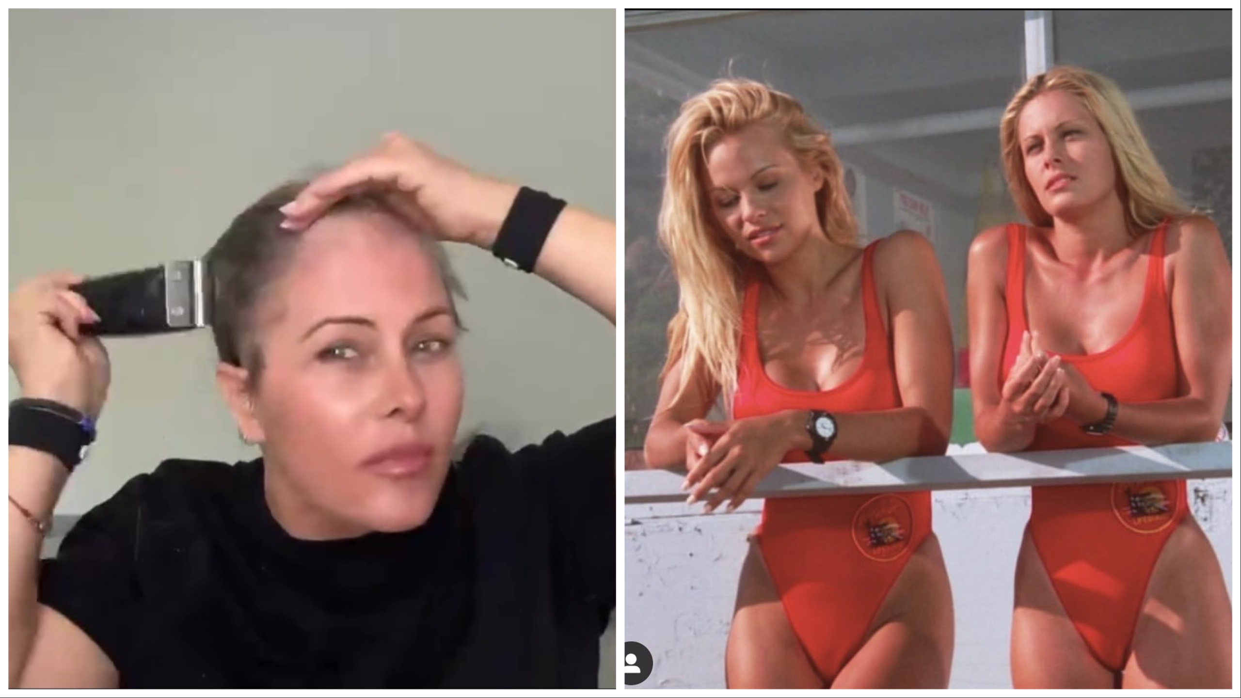 Video shock dell'ex bagnina di Baywatch si rade a zero: "Comando io, non il cancro al seno"