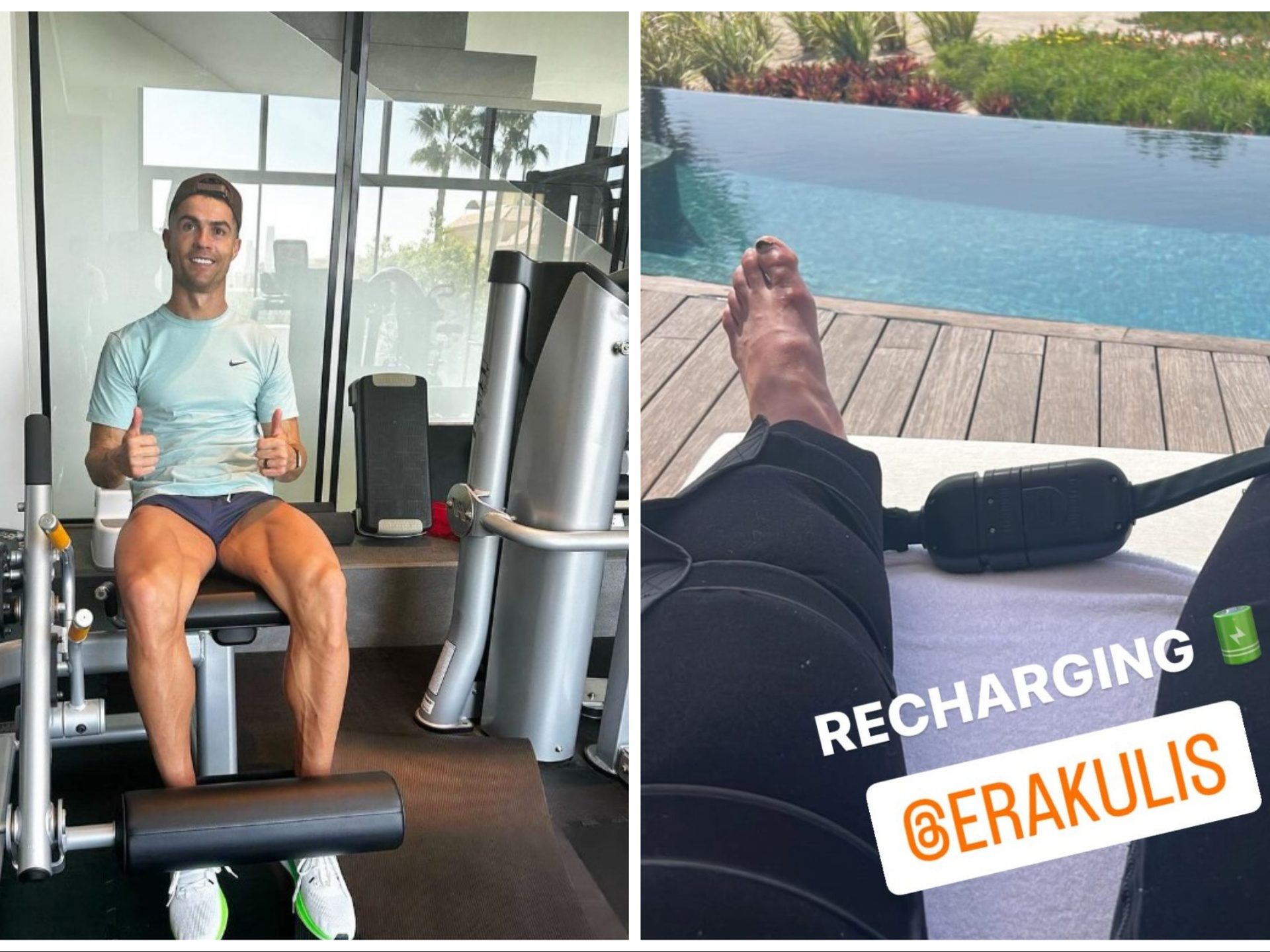 Piedi gonfi e doloranti: Cristiano Ronaldo preoccupa i fan con una foto shock