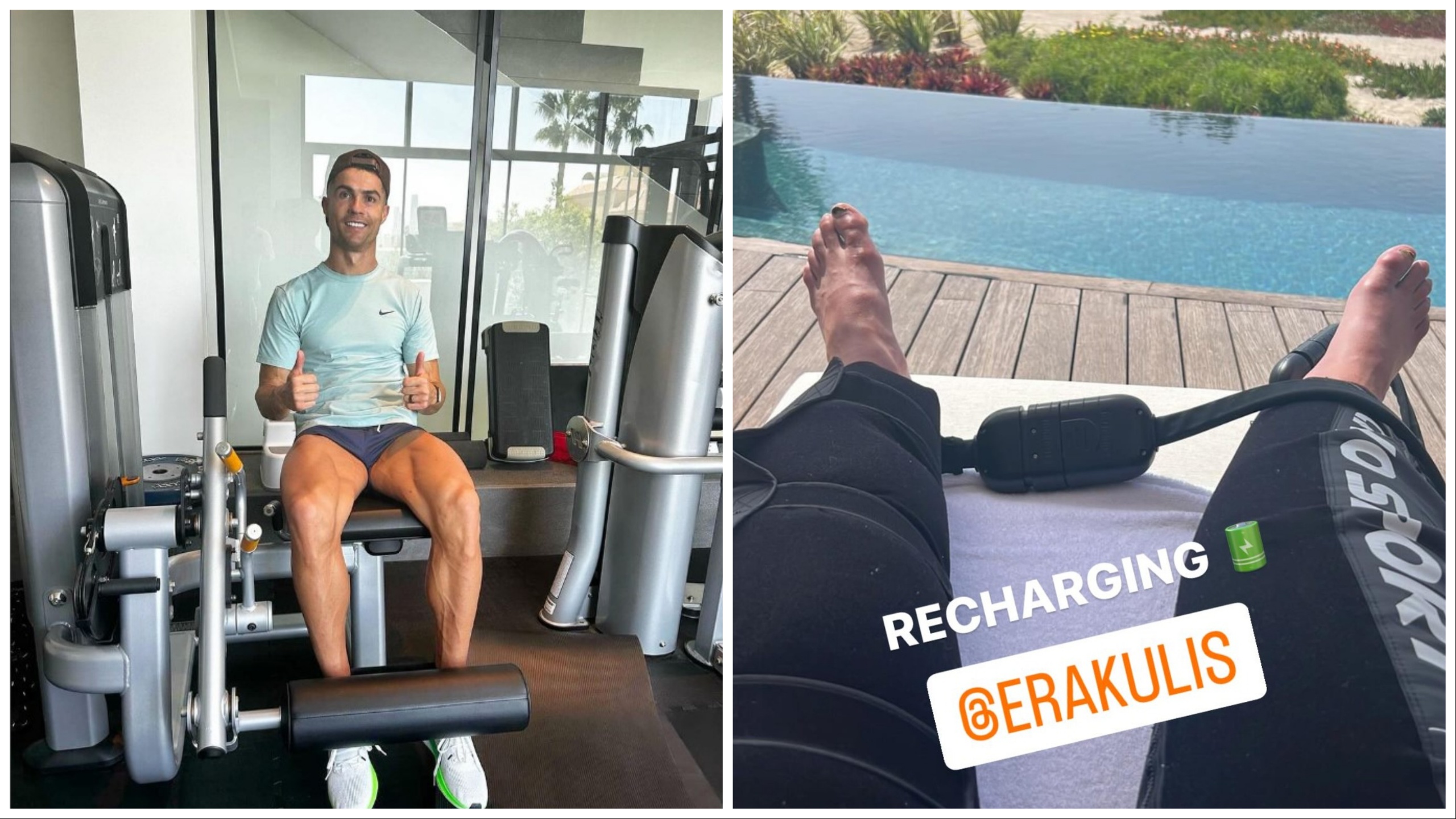 Piedi gonfi e doloranti: Cristiano Ronaldo preoccupa i fan con una foto shock