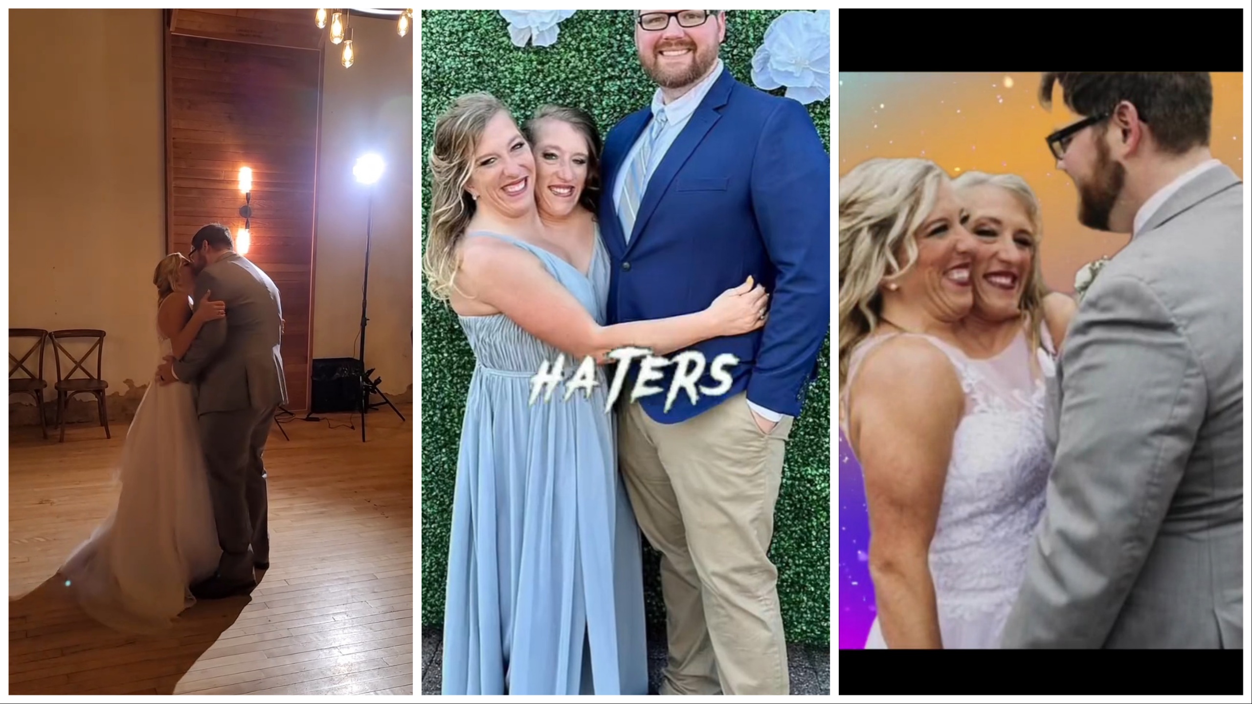 Il matrimonio delle gemelle siamesi scatena gli hater: e loro rispondono