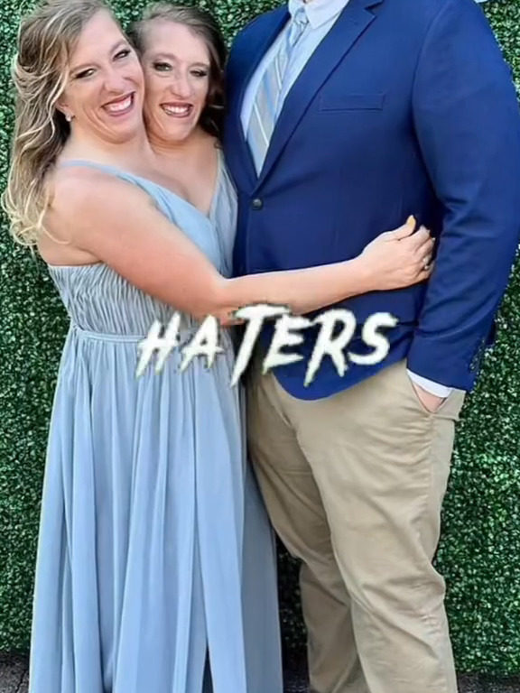 El matrimonio de las gemelas siamesas desata a los haters: y estos responden