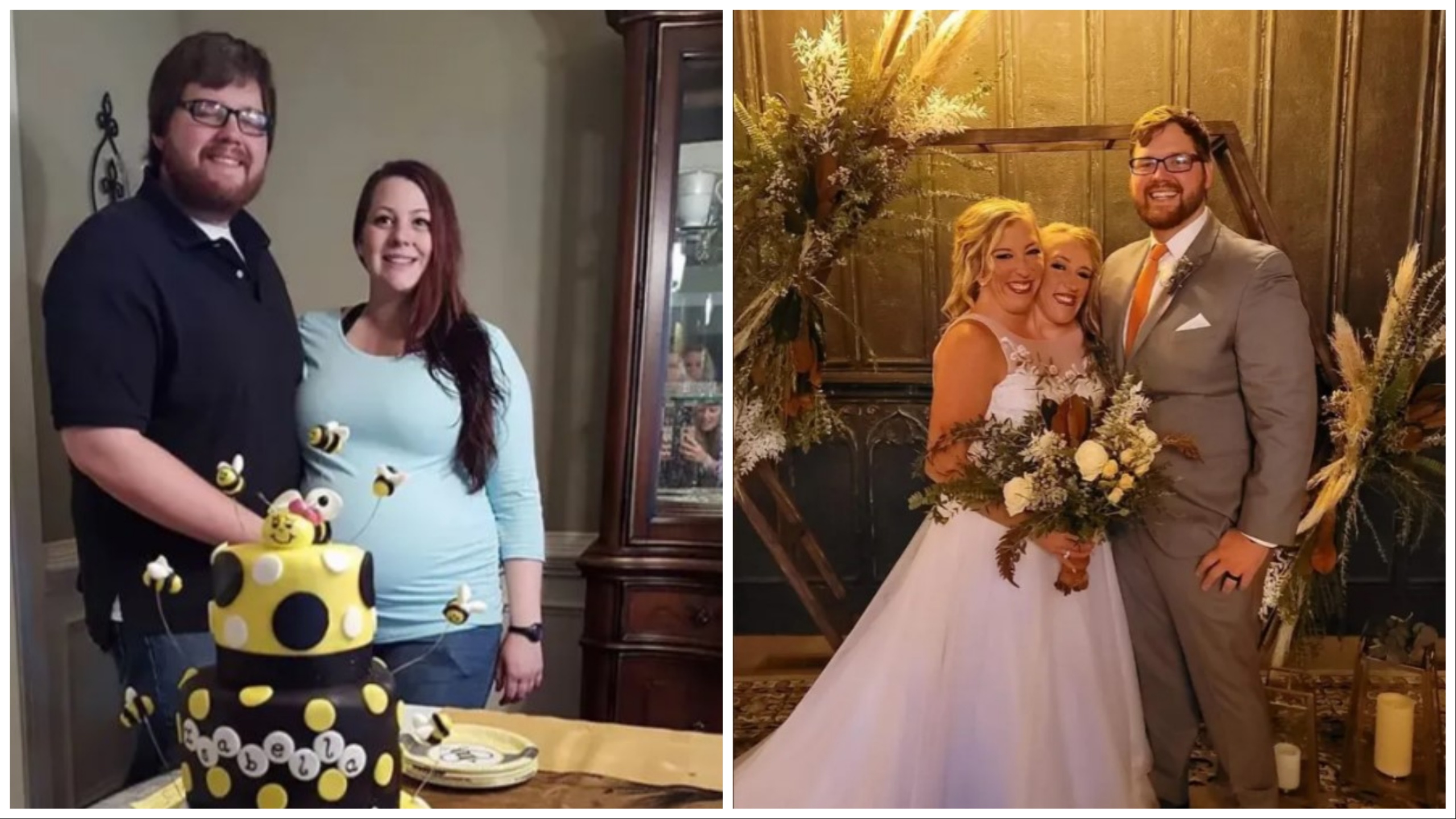 Gemelle siamesi, il marito denunciato dalla ex moglie: ecco perché