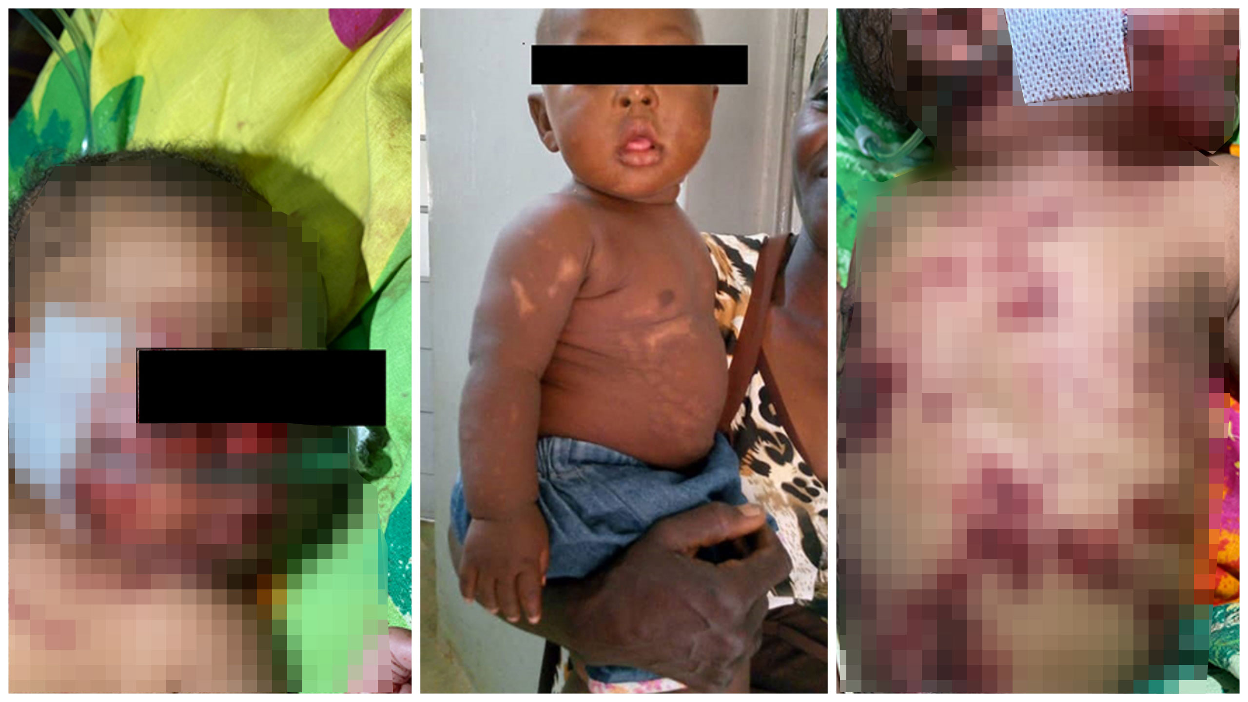 Neonata seppellita viva dalla madre, salvata dalla nonna dopo 6 ore: un miracolo