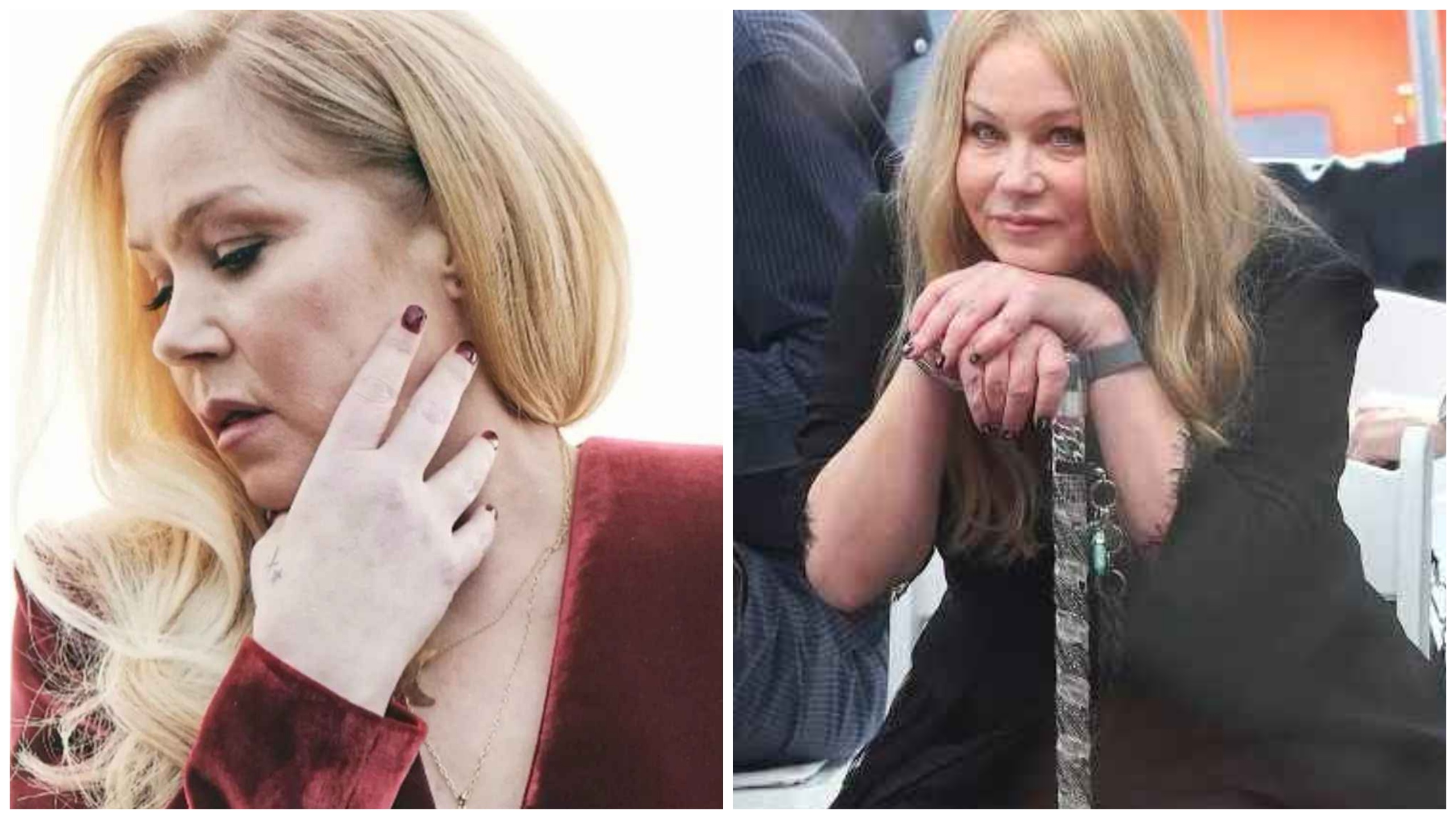 Christina Applegate non fa più la doccia per colpa della sclerosi multipla