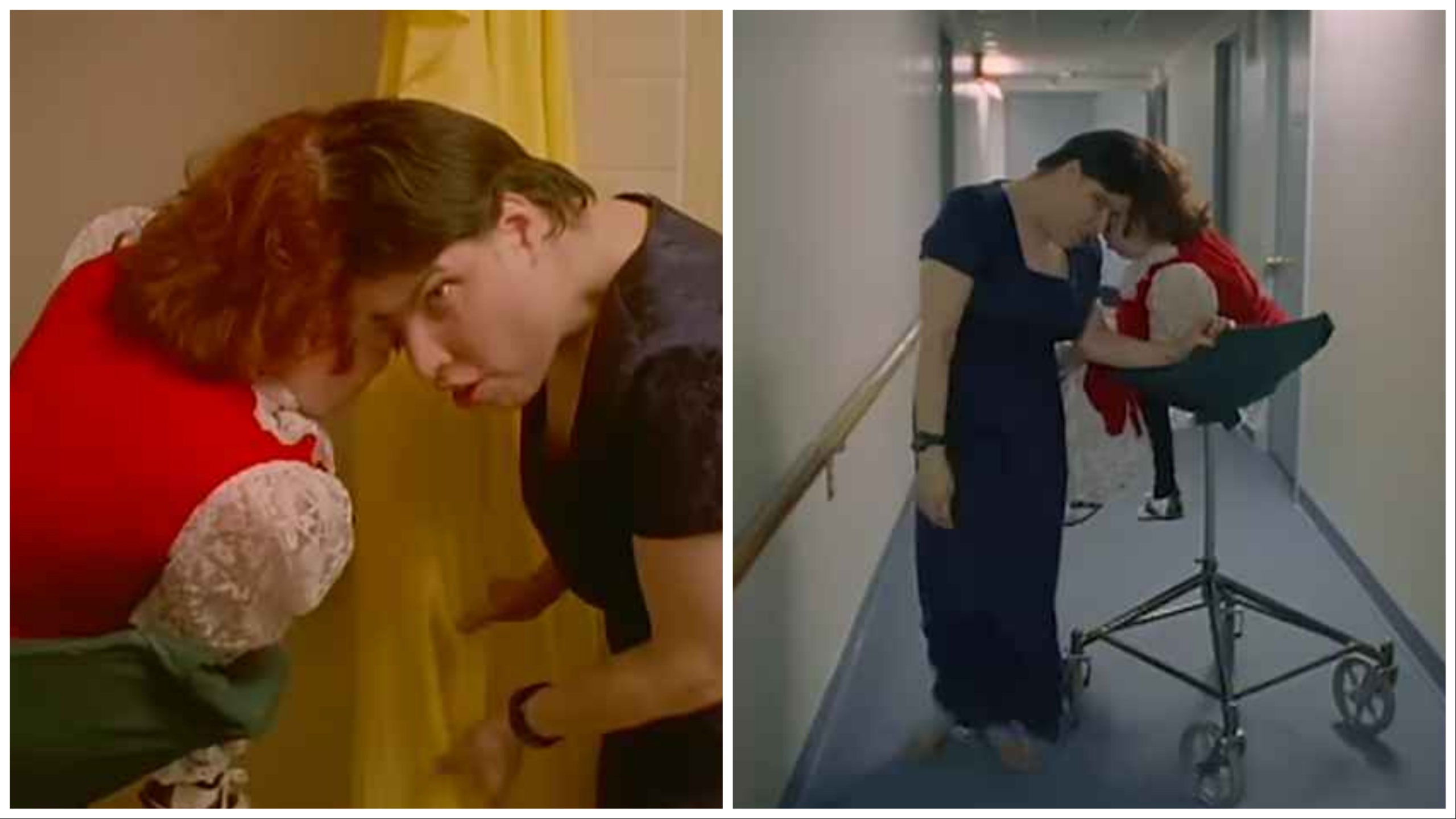 Les jumeaux siamois les plus vieux du monde sont décédés : frère et sœur avaient 62 ans