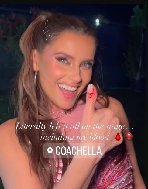 Nelly Furtado al Coachella si schianta e si ferisce sangue sul palco