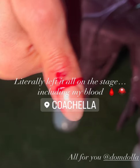 Nelly Furtado al Coachella si schianta e si ferisce sangue sul palco