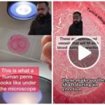 Una fetta di pene passato al microscopio: video scientifico fa il botto