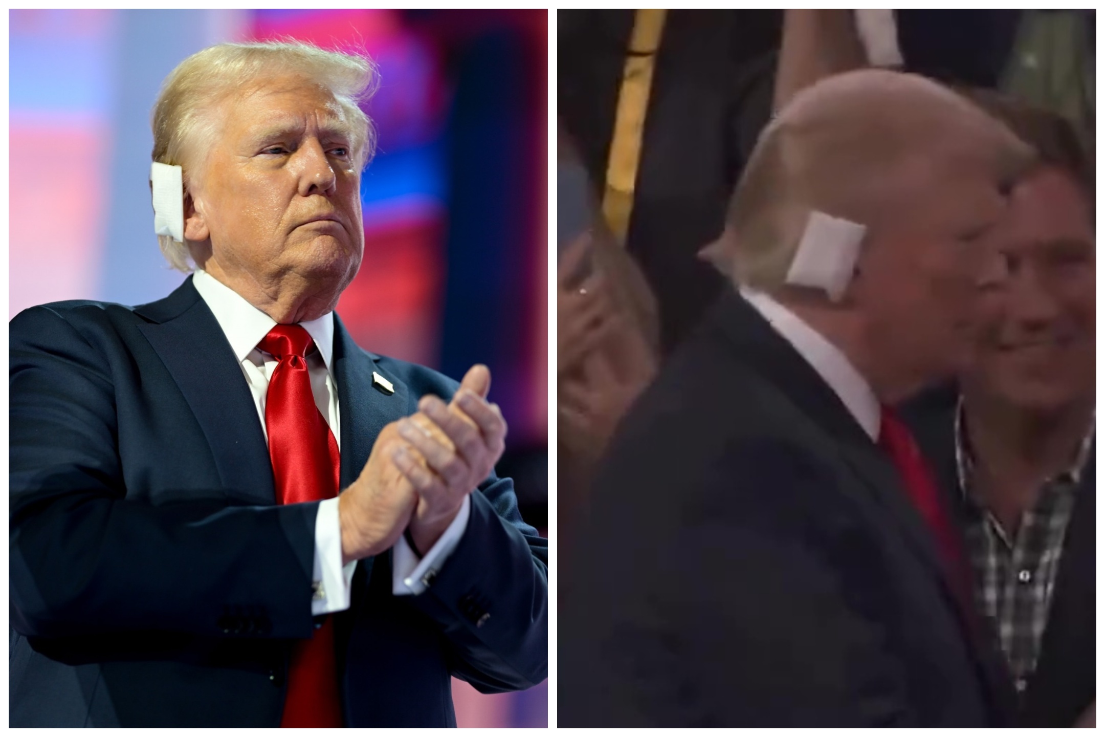 Misterio sobre la herida de Trump, falta el informe y el médico insinúa dudas de que realmente sea una bala