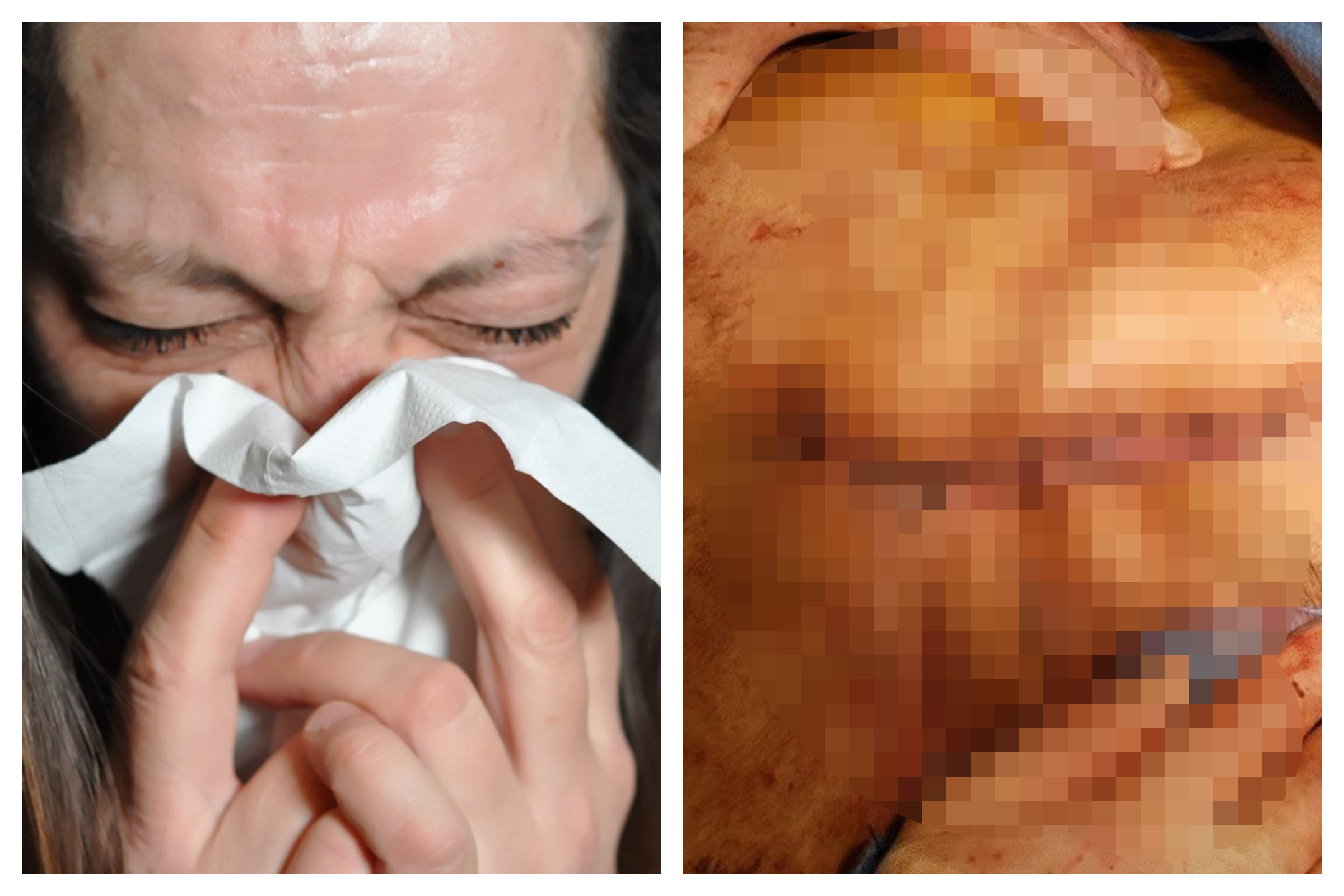 Malata Covid colpo tosse espelle intestino pancia salva