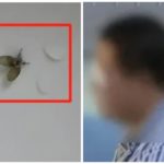 Aplasta una mosca en la cara y pierde el globo ocular: la increíble historia
