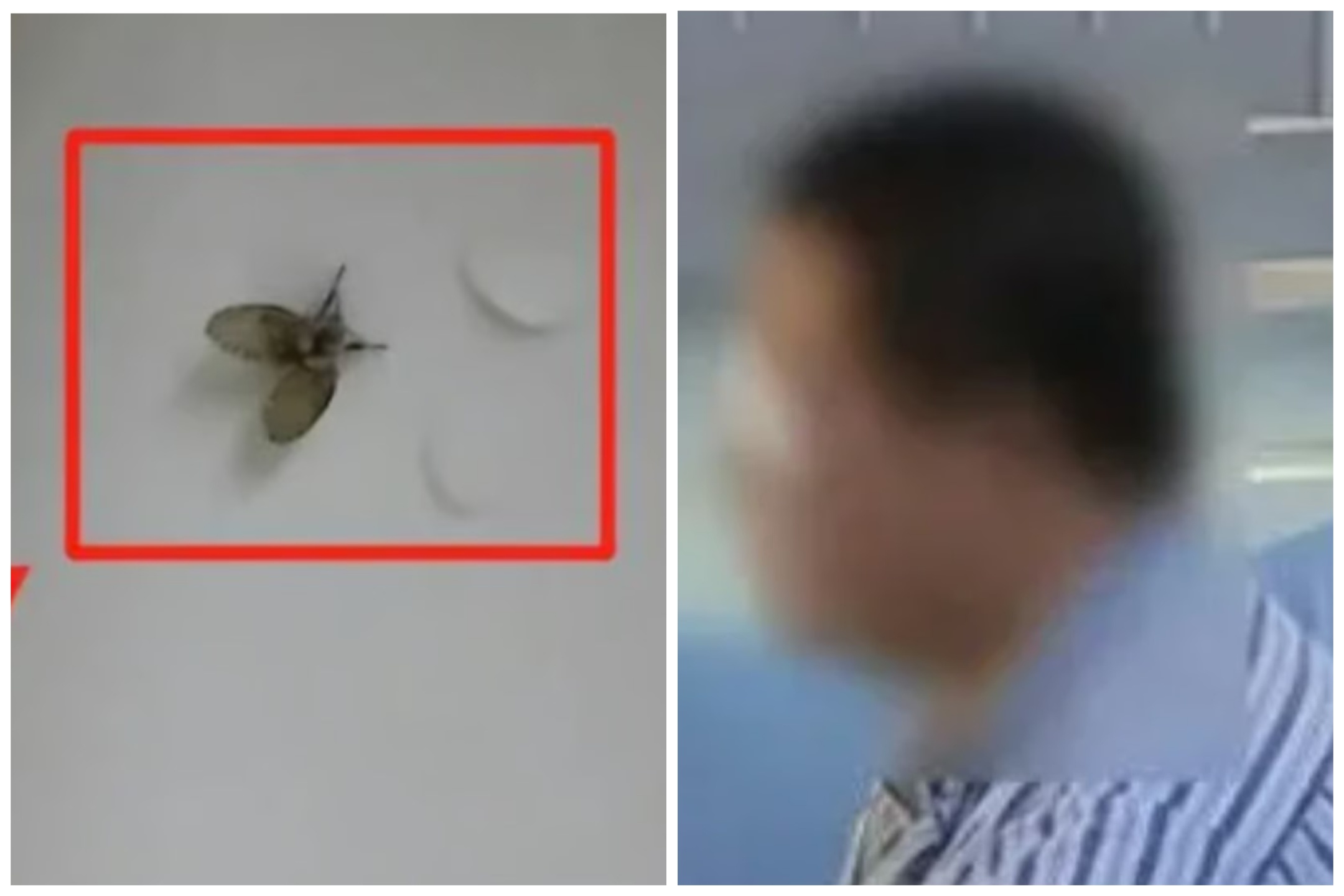 Aplasta una mosca en la cara y pierde el globo ocular: la increíble historia