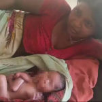 Recién nacido con dos caras, cuatro piernas y brazos: la madre no puede alimentarlo y muere