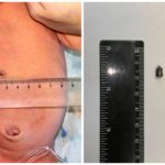 Accidentalmente dispara en el vientre a su esposa embarazada, bebé recién nacido nace con bala en el cuerpo