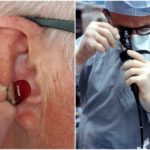 Coloscopie douloureuse, un médecin âgé et sourd n'entend pas les cris