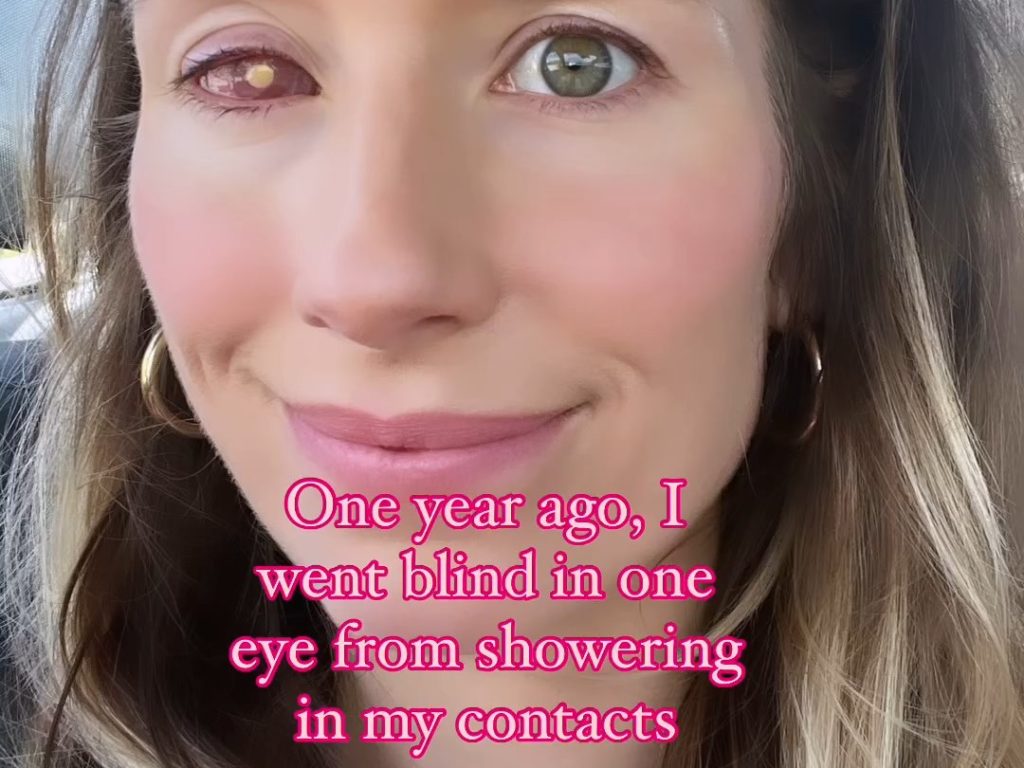 Elle devient aveugle à cause d'une simple erreur avec ses lentilles de contact. Ne sois pas comme moi.