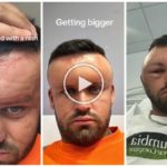 El tinte para el cabello hace que tu cabeza se hinche y casi explote, pone en riesgo tu vida, he aquí por qué