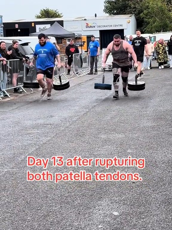 El campeón Strongman Dan Jones se rompe tendones y rótulas en una competencia: impactante video