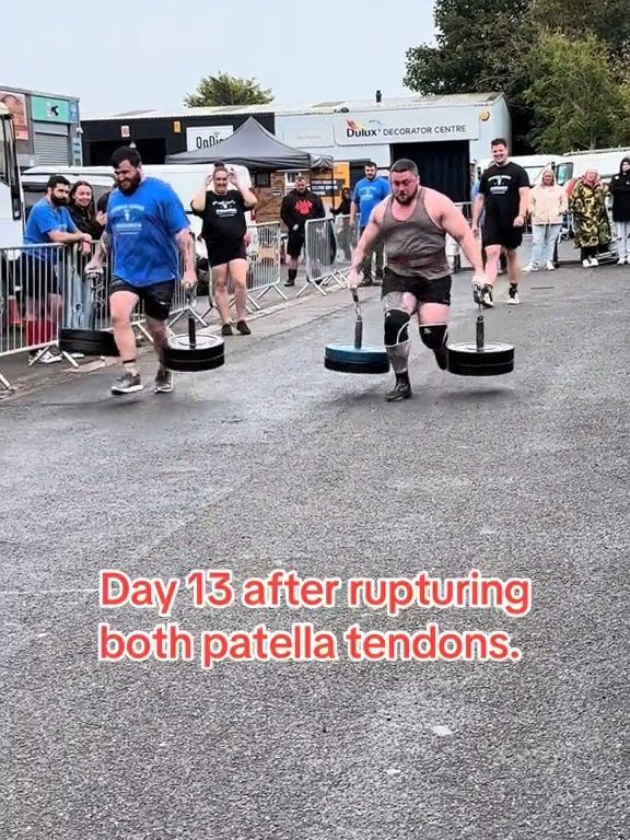 Il campione di strongman Dan Jones si spezza tendini e rotule in una gara: video shock