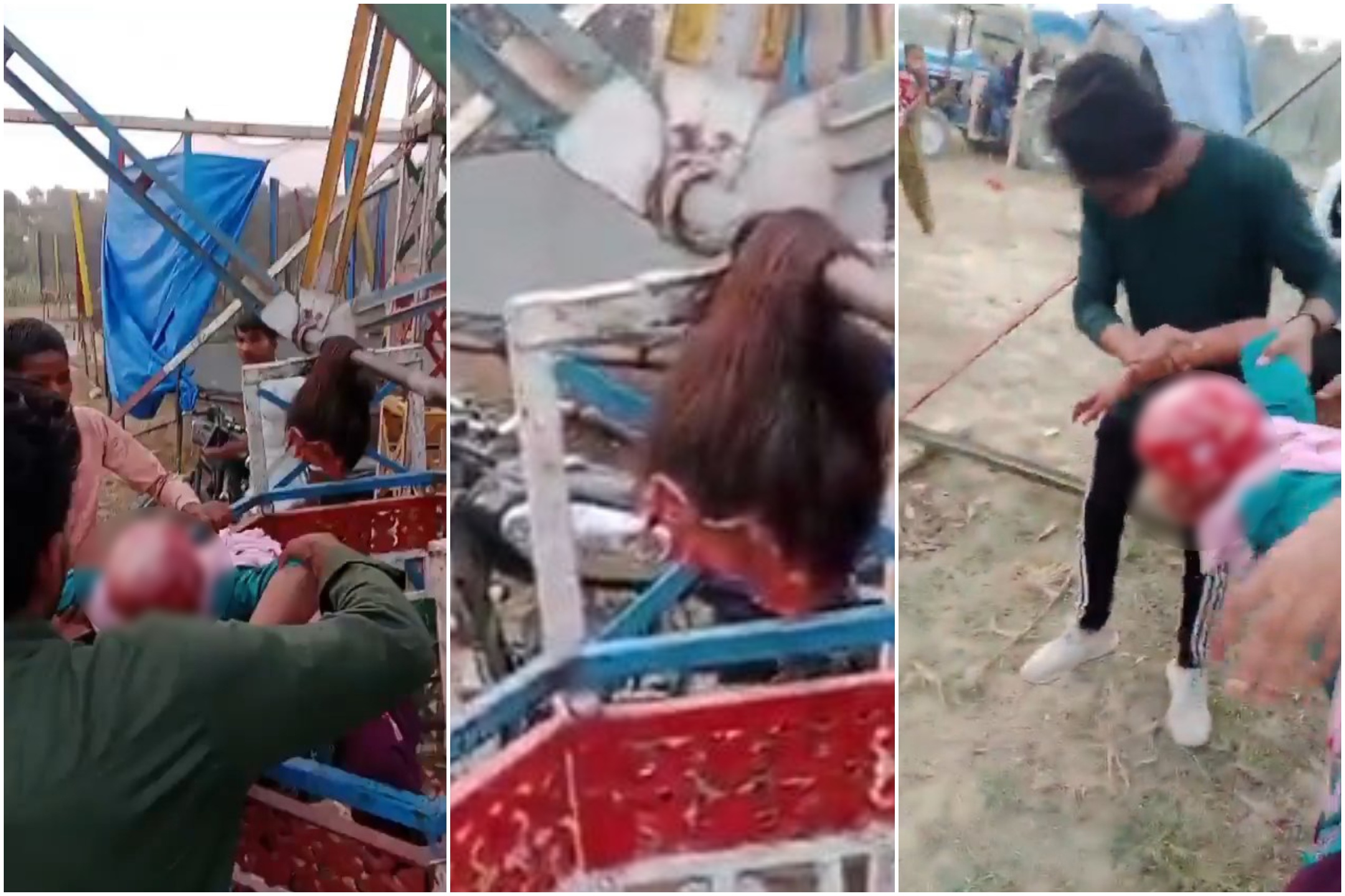 Niña se queda atascada en una noria y le arrancan el cuero cabelludo