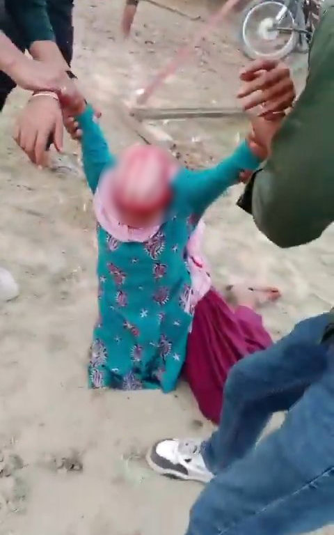 Niña se queda atascada en una noria y le arrancan el cuero cabelludo